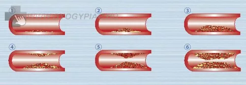 Érszűkűlet mérő - Rossmax sb200 arterosclerosis meghatározó  pulzoximéter