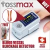 Érszűkűlet mérő - Rossmax sb200 arterosclerosis meghatározó  pulzoximéter