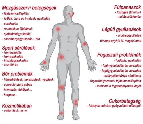 +választható ajándék! Megújult Li-ion akkumulátoros Safe Laser 150 Lézerkészülék orrkezelővel 3 év garanciával Infra SL150 lágy lézer